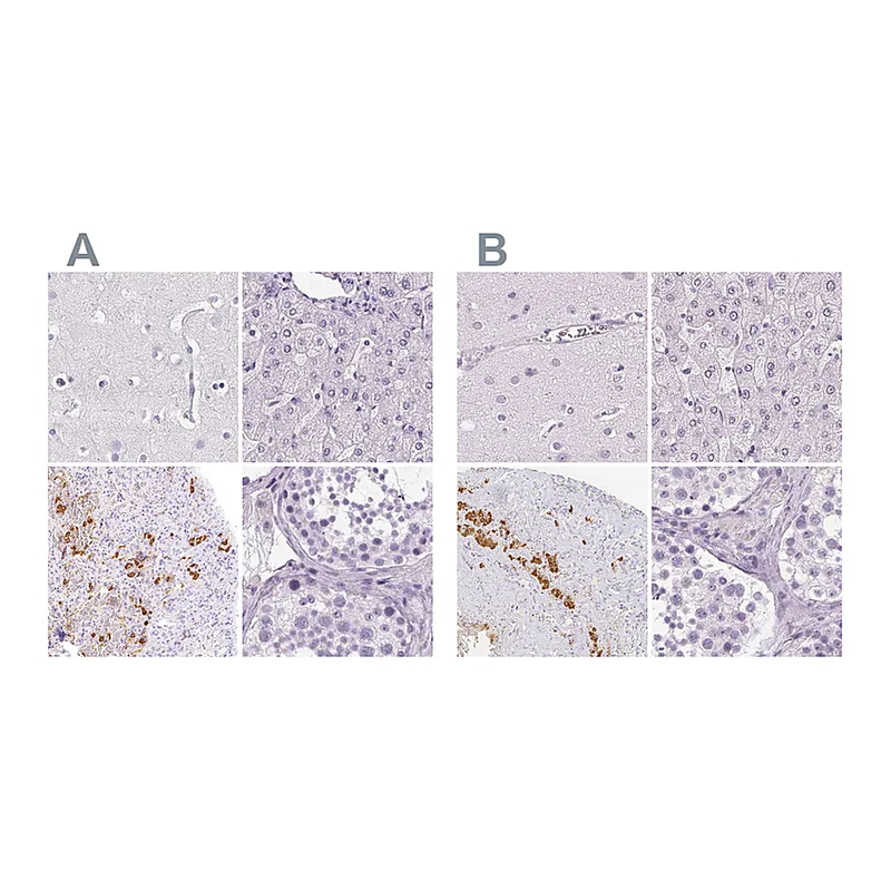 Atlas Antibodies Anti-POMC Antibody