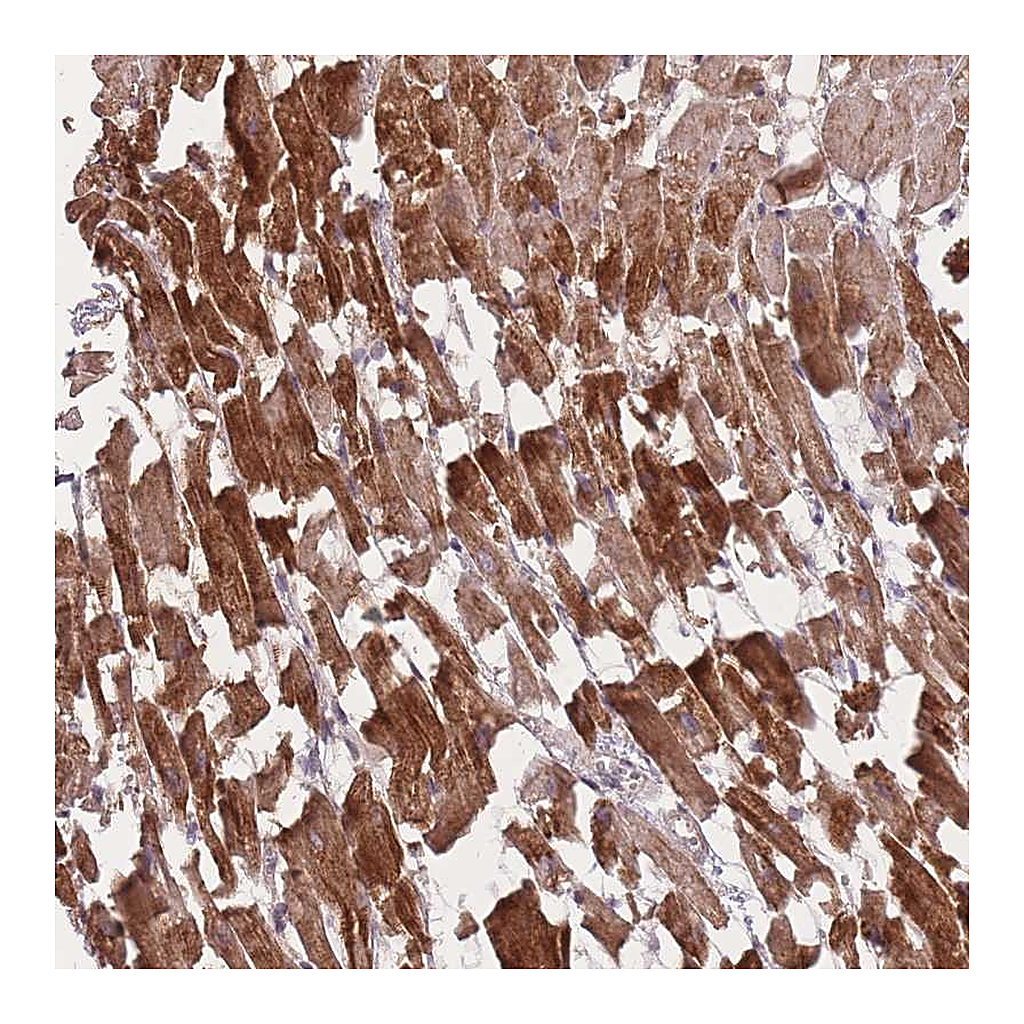 Atlas Antibodies Anti-POM121 Antibody