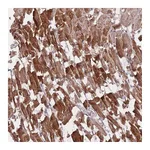 Atlas Antibodies Anti-POM121 Antibody