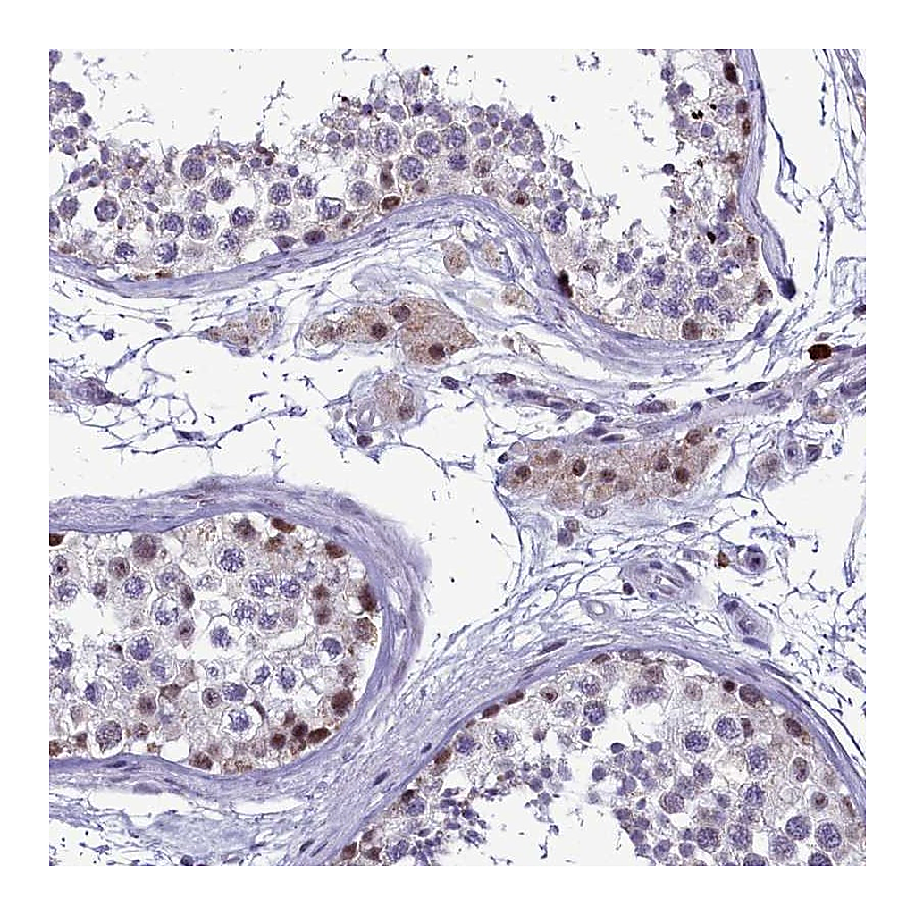 Atlas Antibodies Anti-POM121L2 Antibody