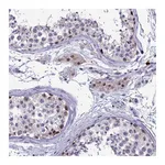 Atlas Antibodies Anti-POM121L2 Antibody
