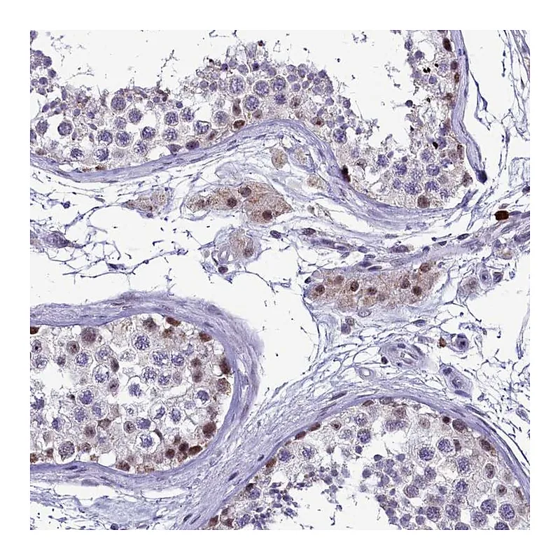 Atlas Antibodies Anti-POM121L2 Antibody