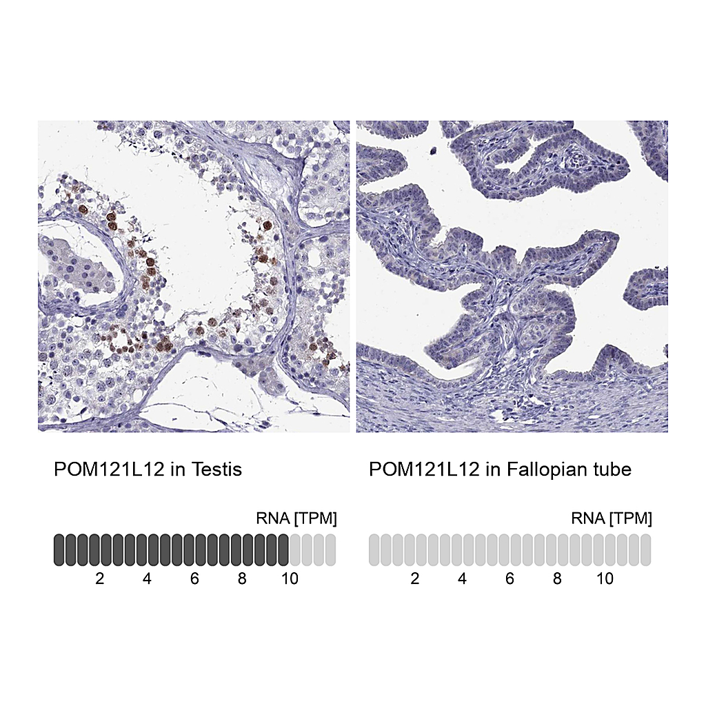 Atlas Antibodies Anti-POM121L12 Antibody