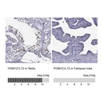 Atlas Antibodies Anti-POM121L12 Antibody