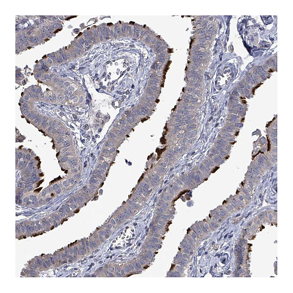 Atlas Antibodies Anti-POMGNT2 Antibody