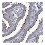 Atlas Antibodies Anti-POMGNT2 Antibody