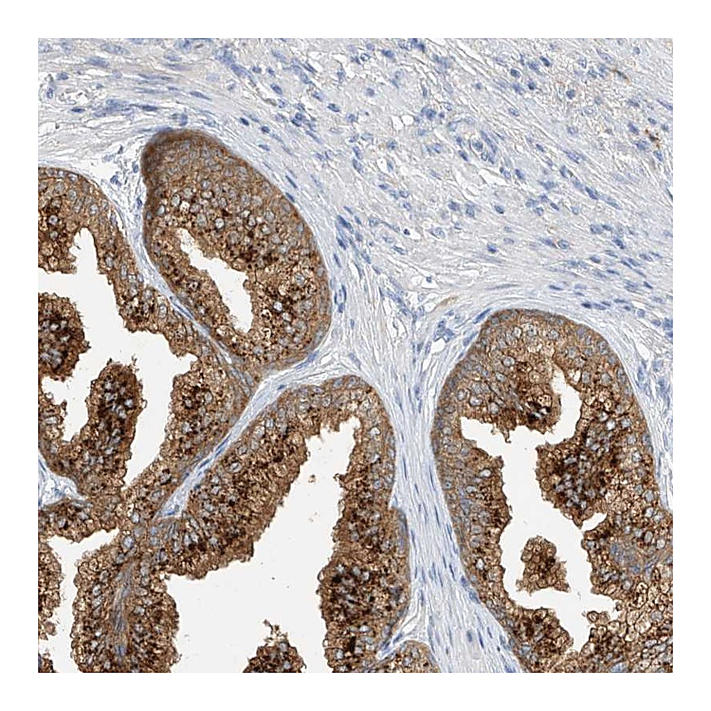 Atlas Antibodies Anti-POMGNT2 Antibody