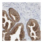 Atlas Antibodies Anti-POMGNT2 Antibody