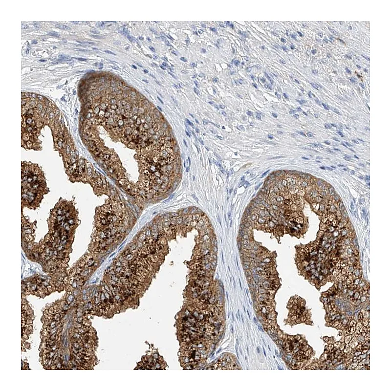 Atlas Antibodies Anti-POMGNT2 Antibody