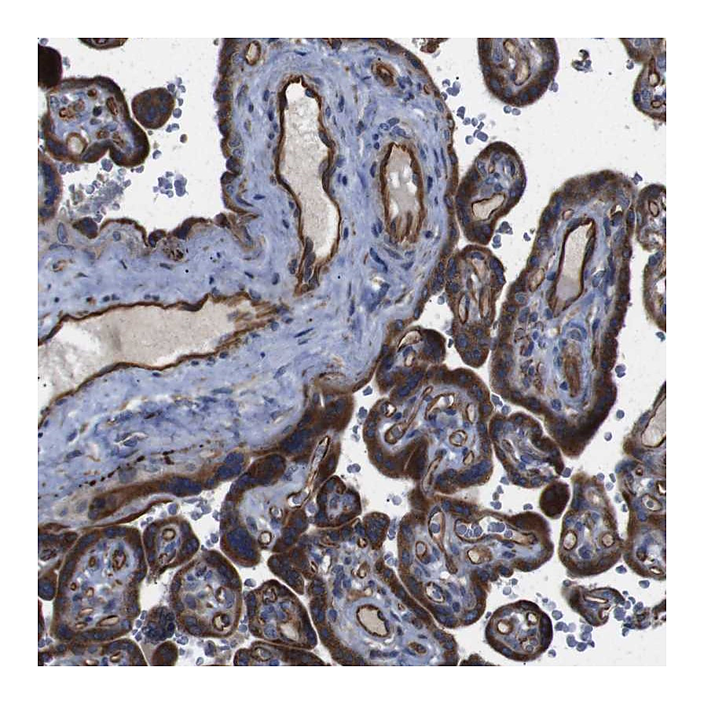 Atlas Antibodies Anti-POMK Antibody