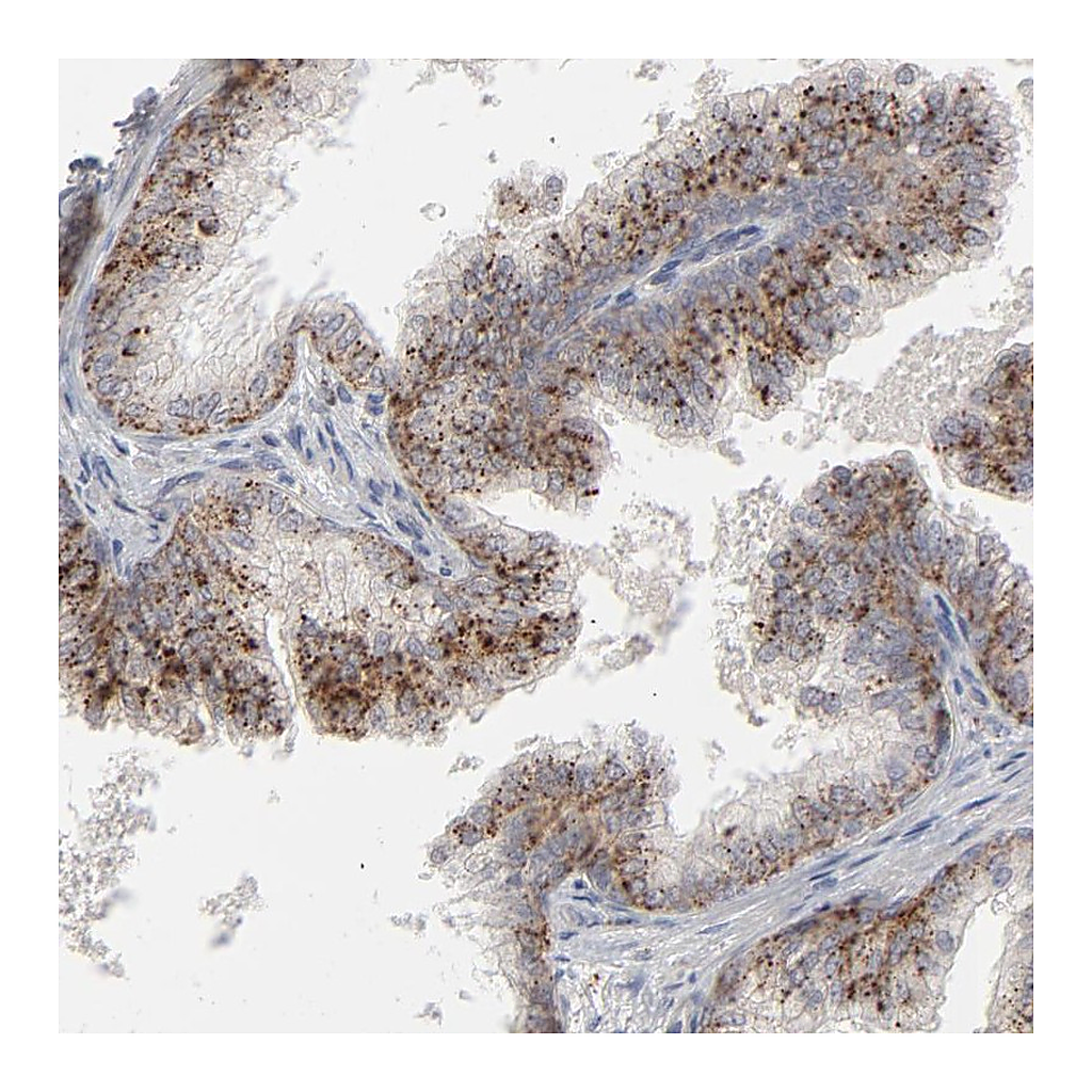 Atlas Antibodies Anti-POMT2 Antibody
