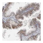Atlas Antibodies Anti-POMT2 Antibody
