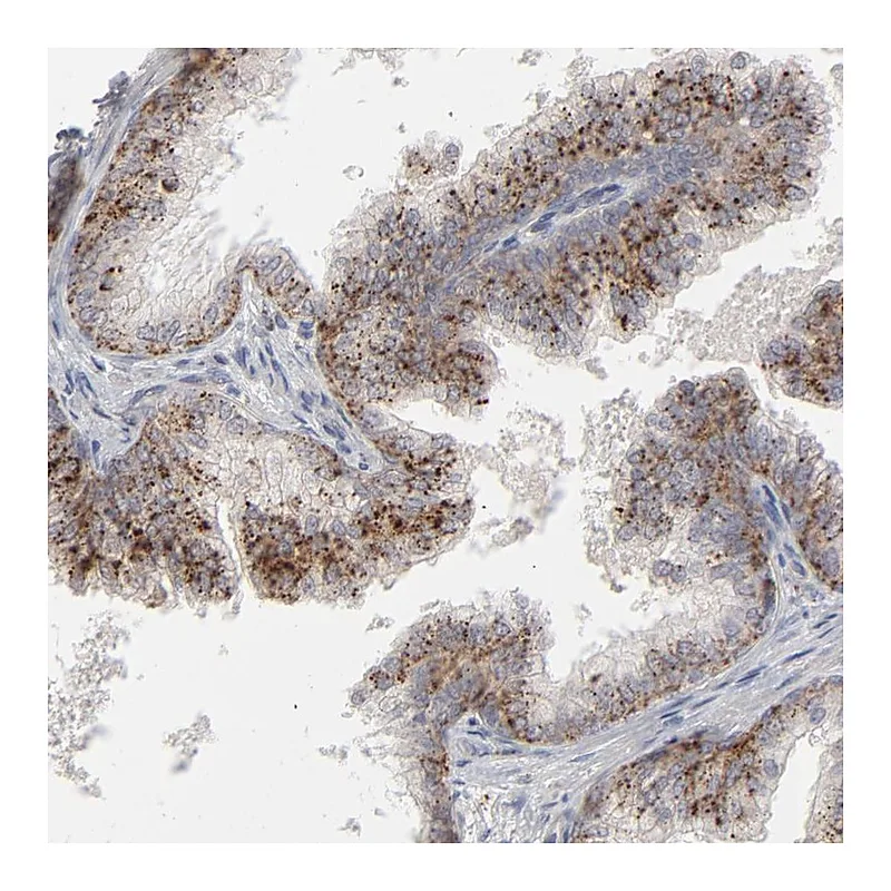 Atlas Antibodies Anti-POMT2 Antibody