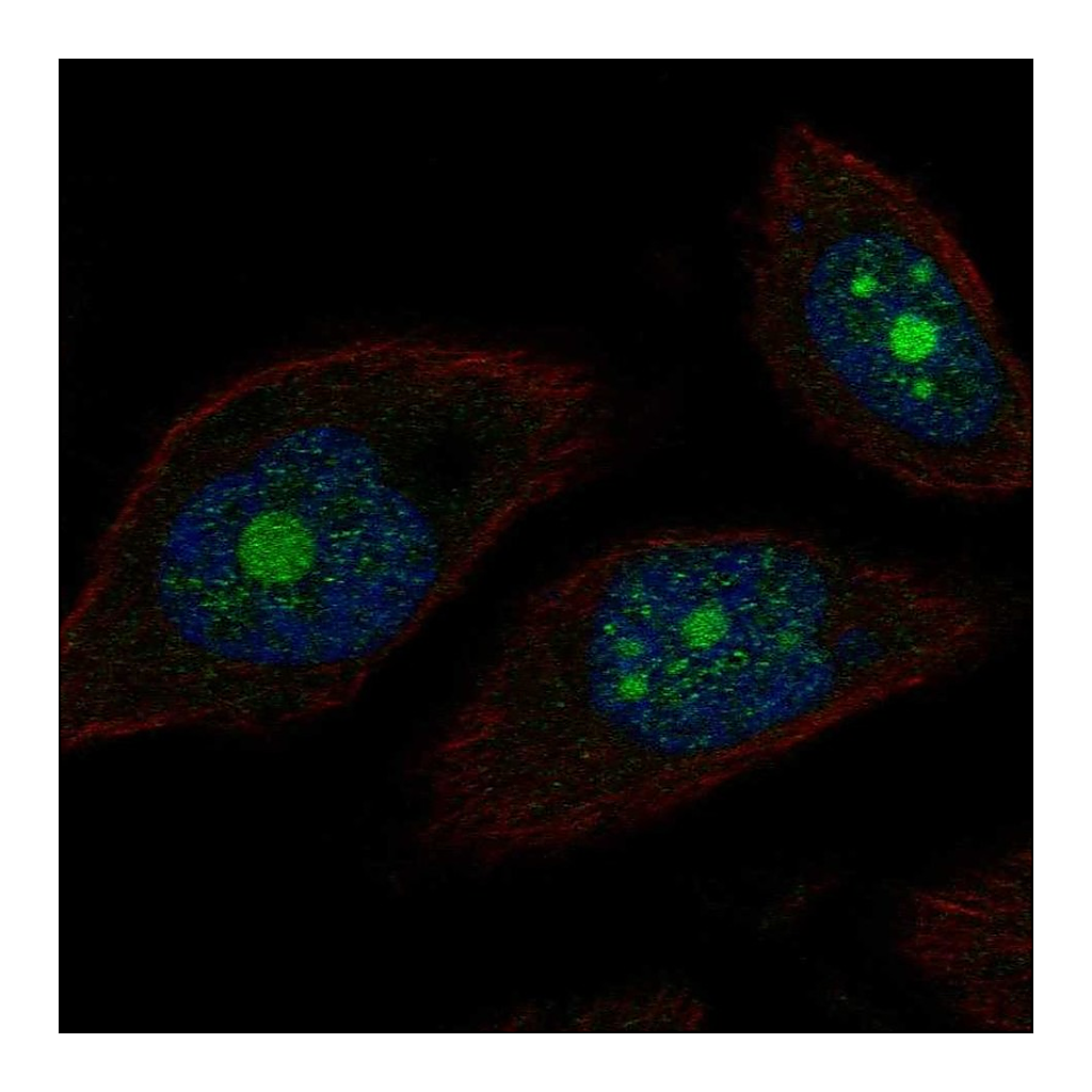 Atlas Antibodies Anti-POP1 Antibody