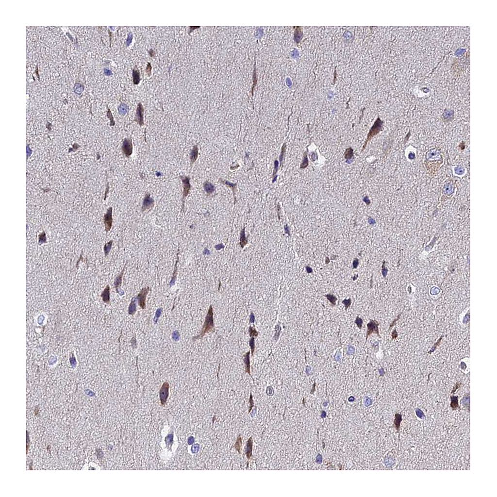 Atlas Antibodies Anti-POP7 Antibody