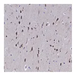 Atlas Antibodies Anti-POP7 Antibody