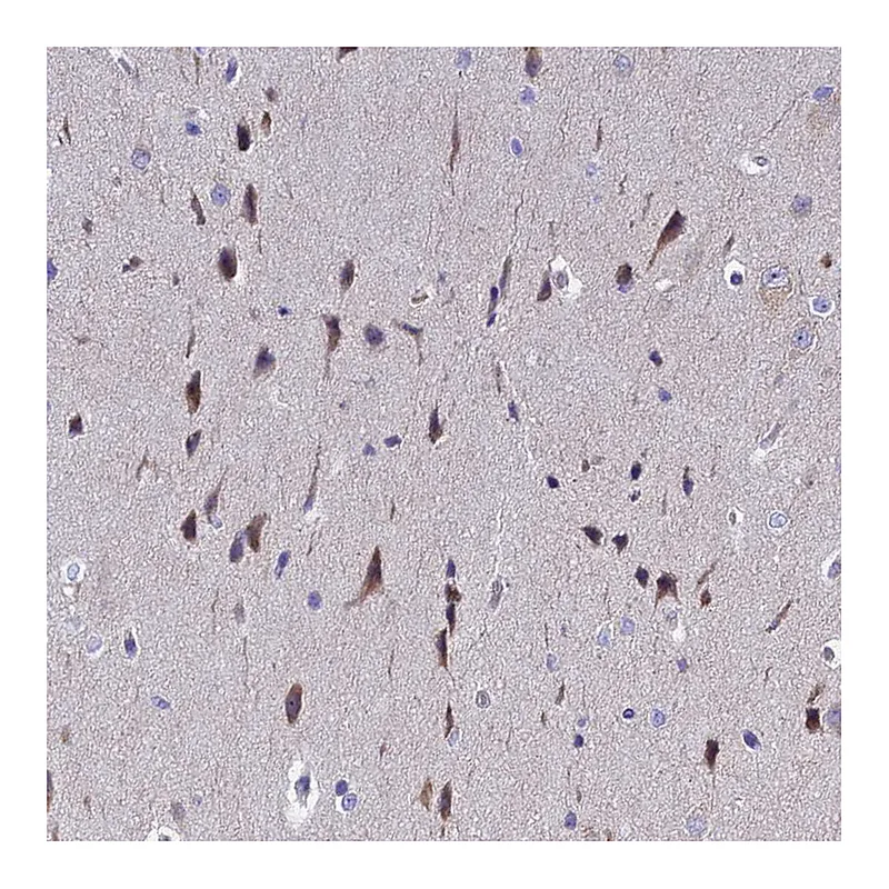 Atlas Antibodies Anti-POP7 Antibody