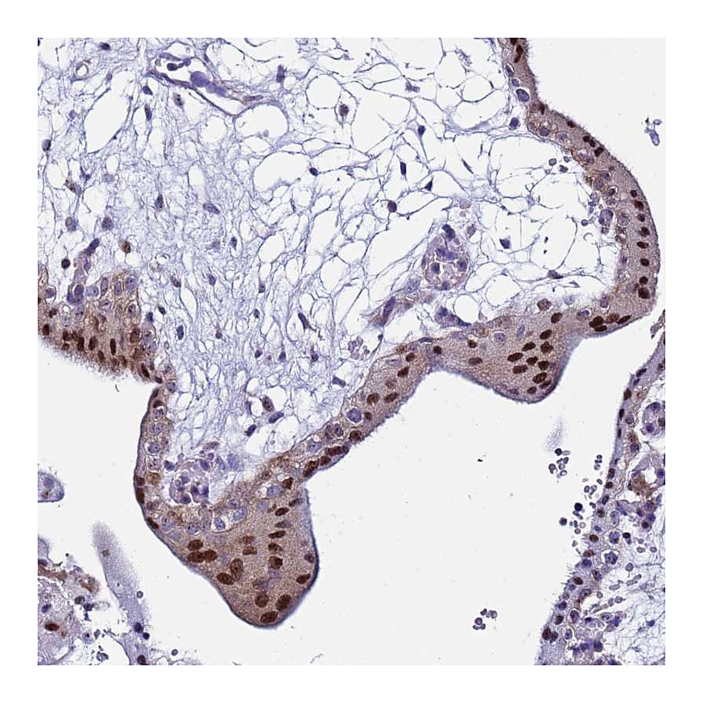 Atlas Antibodies Anti-POP5 Antibody