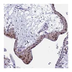 Atlas Antibodies Anti-POP5 Antibody