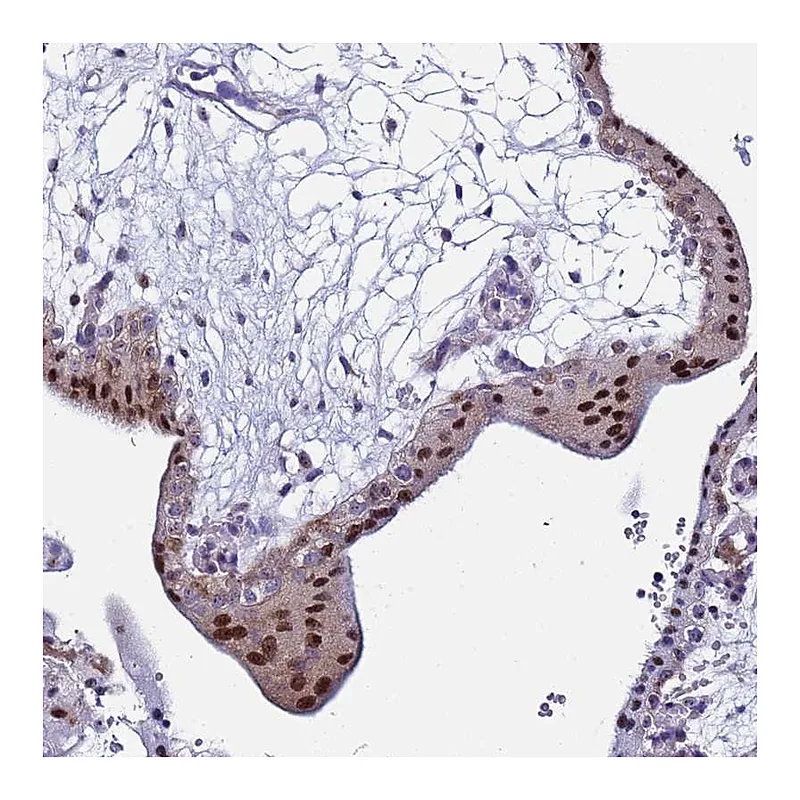Atlas Antibodies Anti-POP5 Antibody