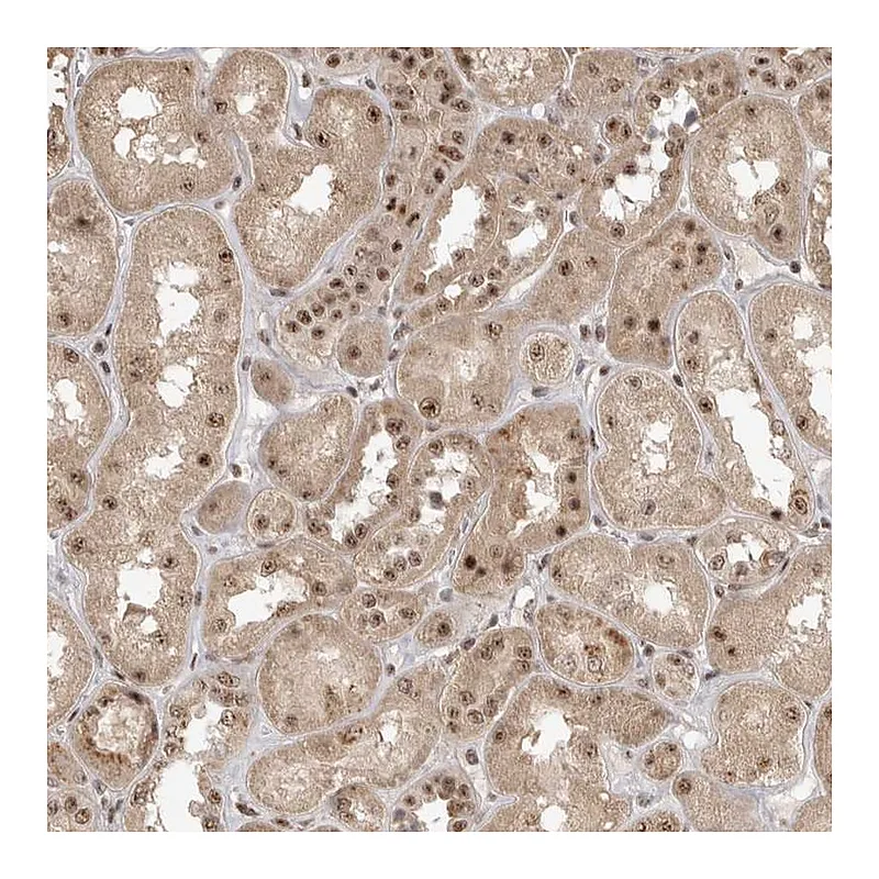 Atlas Antibodies Anti-POMP Antibody