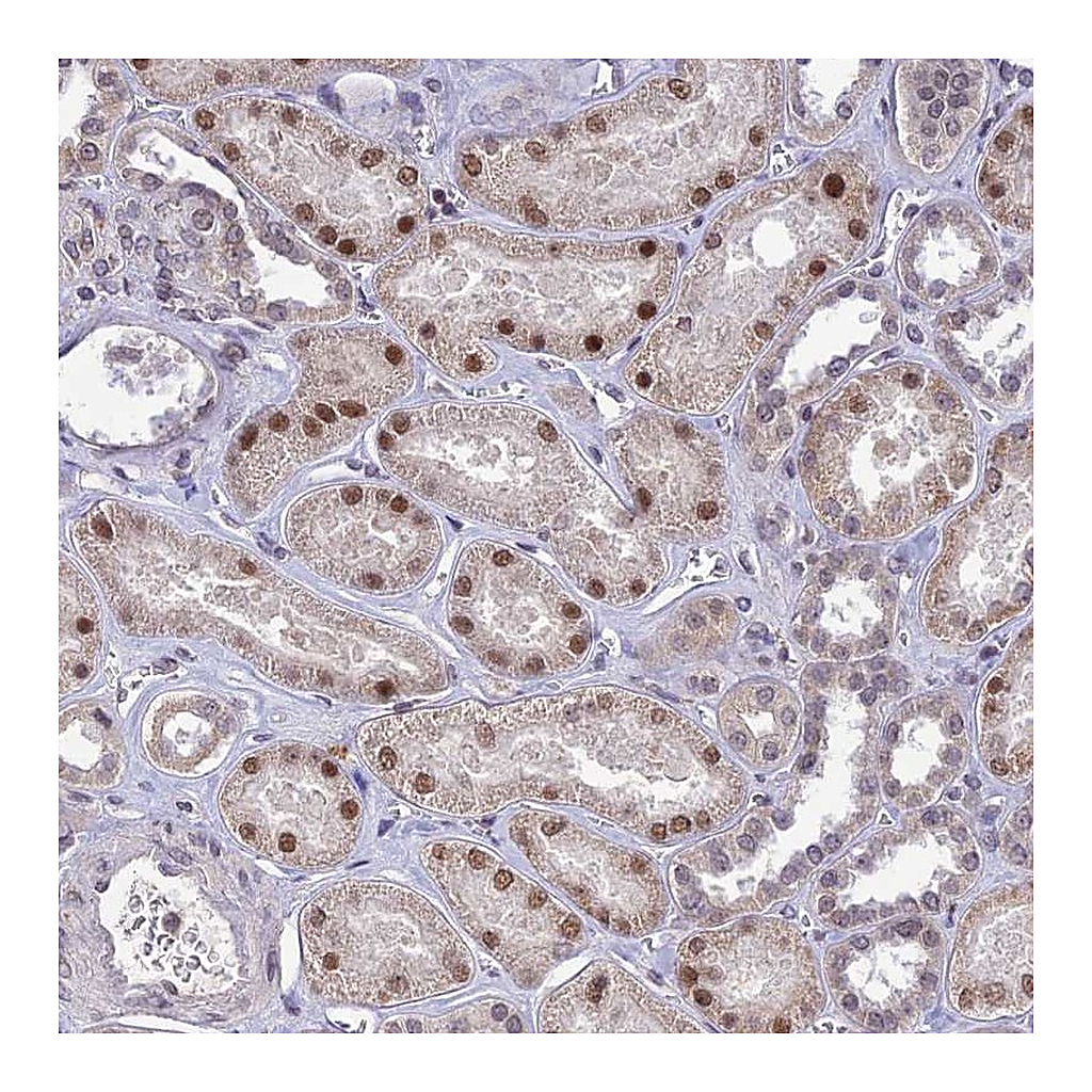 Atlas Antibodies Anti-POP4 Antibody