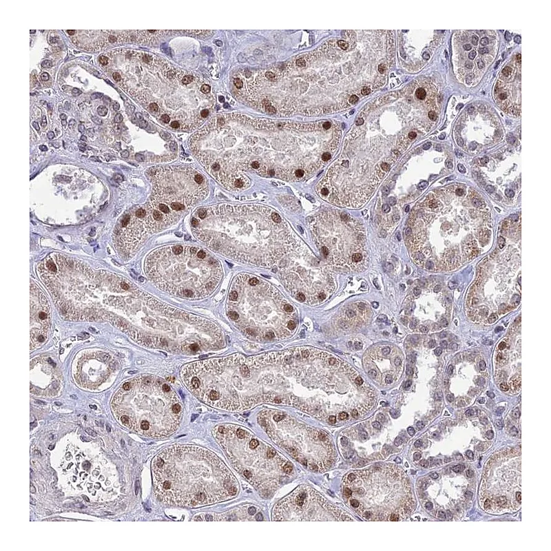 Atlas Antibodies Anti-POP4 Antibody