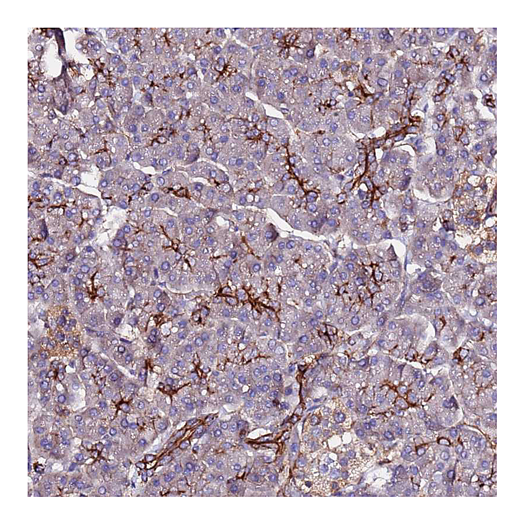 Atlas Antibodies Anti-POTEE Antibody