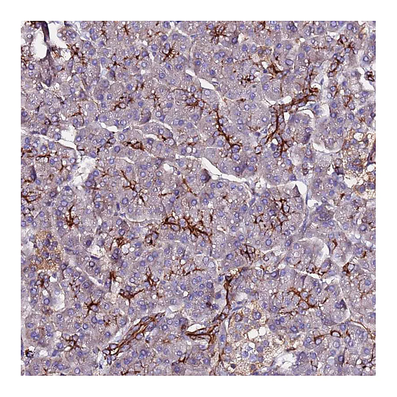 Atlas Antibodies Anti-POTEE Antibody
