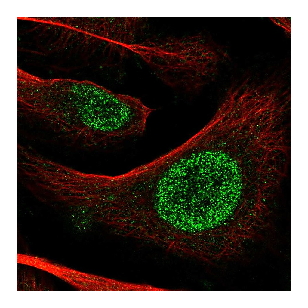 Atlas Antibodies Anti-POT1 Antibody