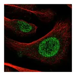 Atlas Antibodies Anti-POT1 Antibody
