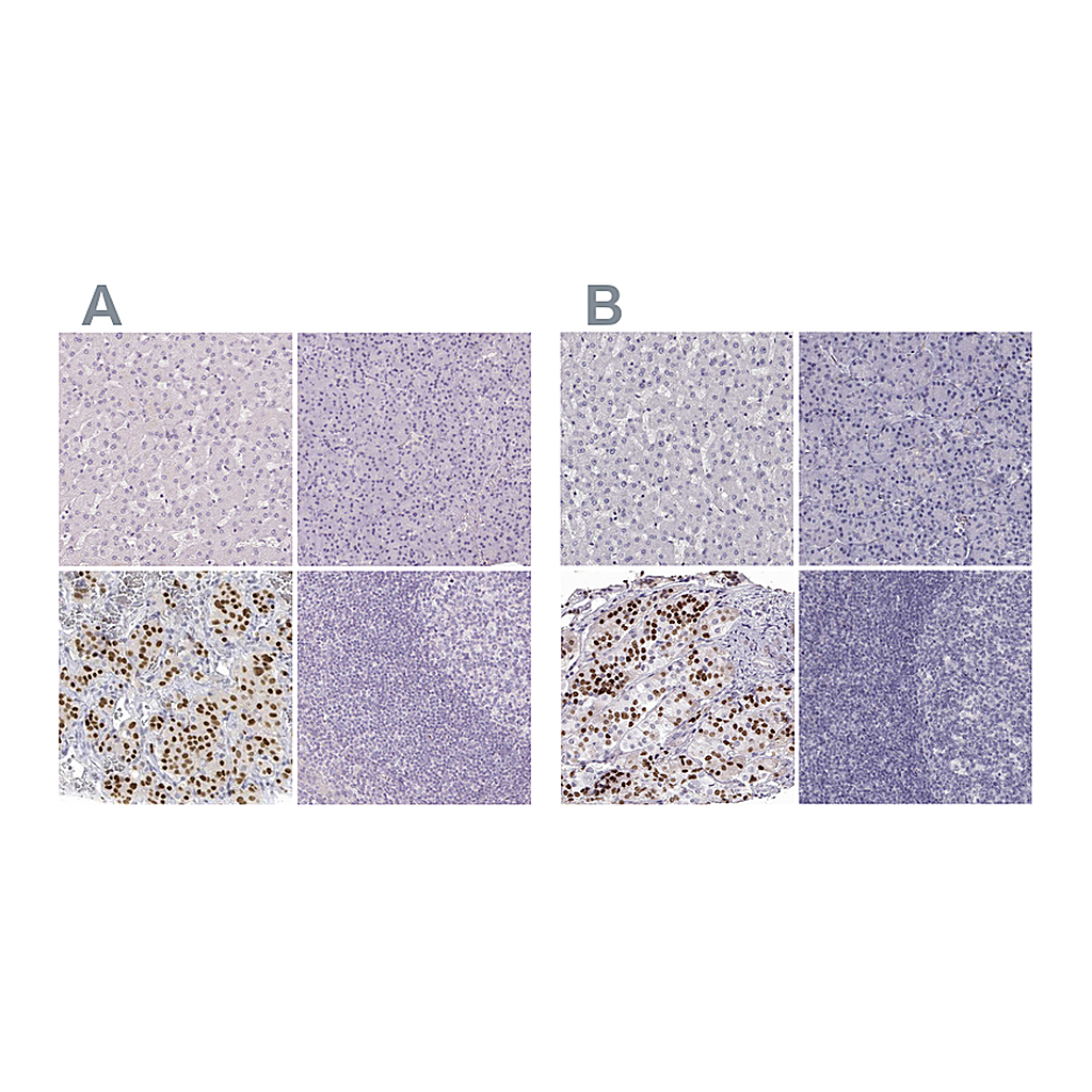 Atlas Antibodies Anti-POU1F1 Antibody