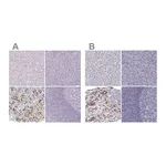Atlas Antibodies Anti-POU1F1 Antibody