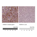 Atlas Antibodies Anti-PORCN Antibody