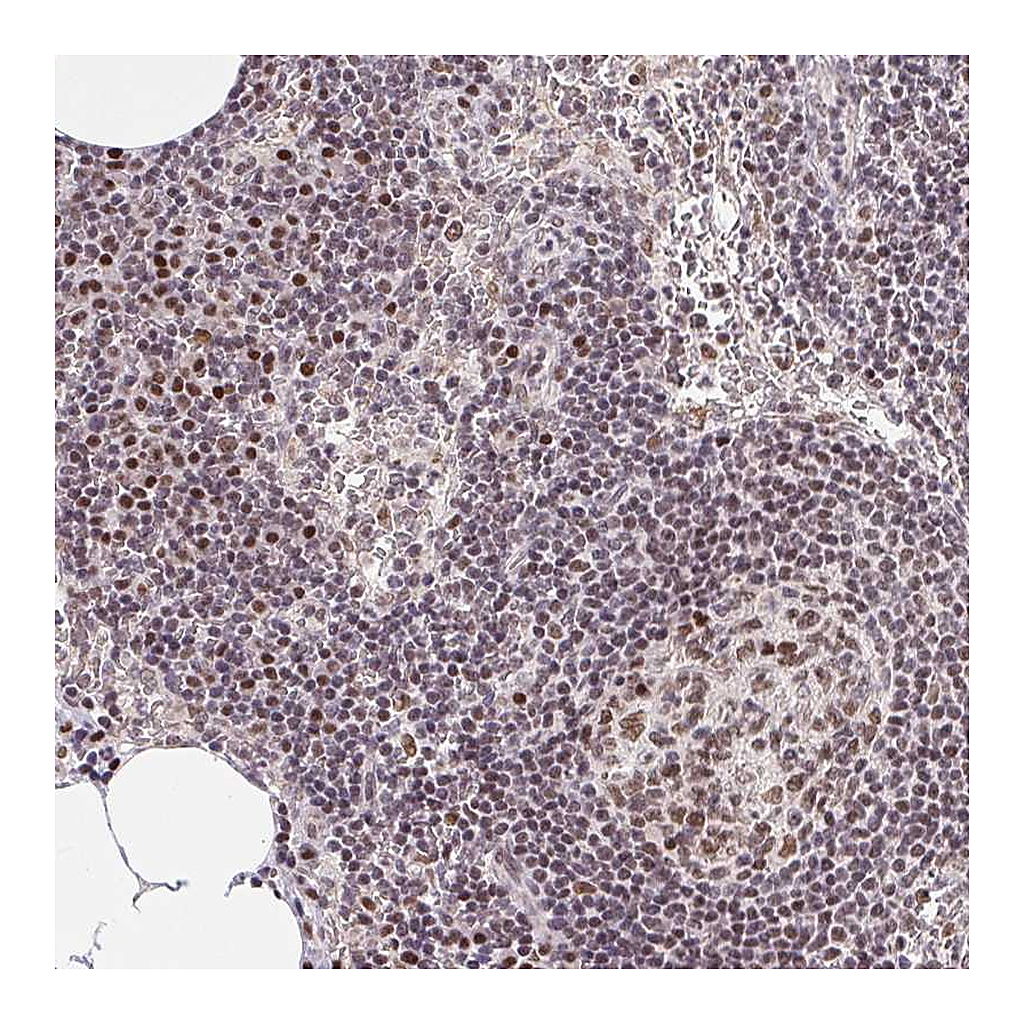 Atlas Antibodies Anti-POU2F1 Antibody