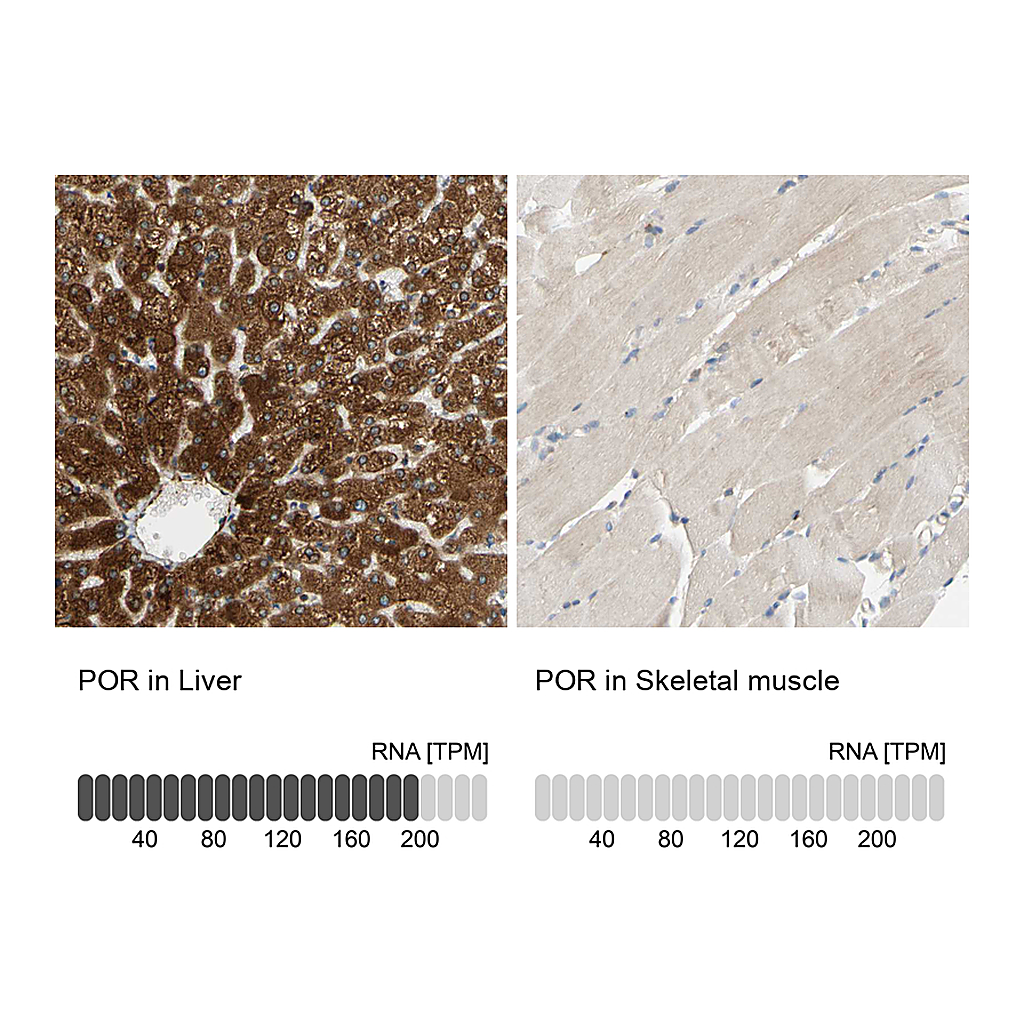 Atlas Antibodies Anti-POR Antibody