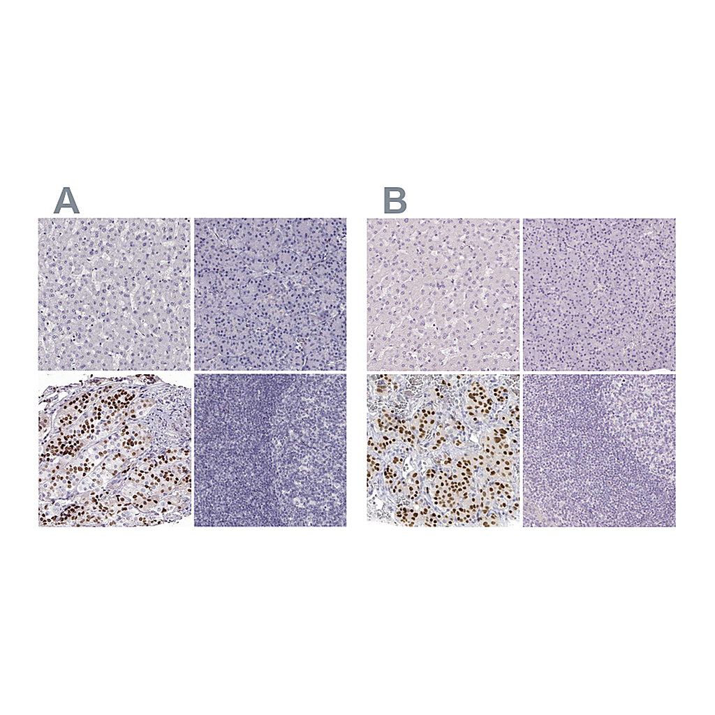 Atlas Antibodies Anti-POU1F1 Antibody
