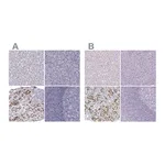 Atlas Antibodies Anti-POU1F1 Antibody