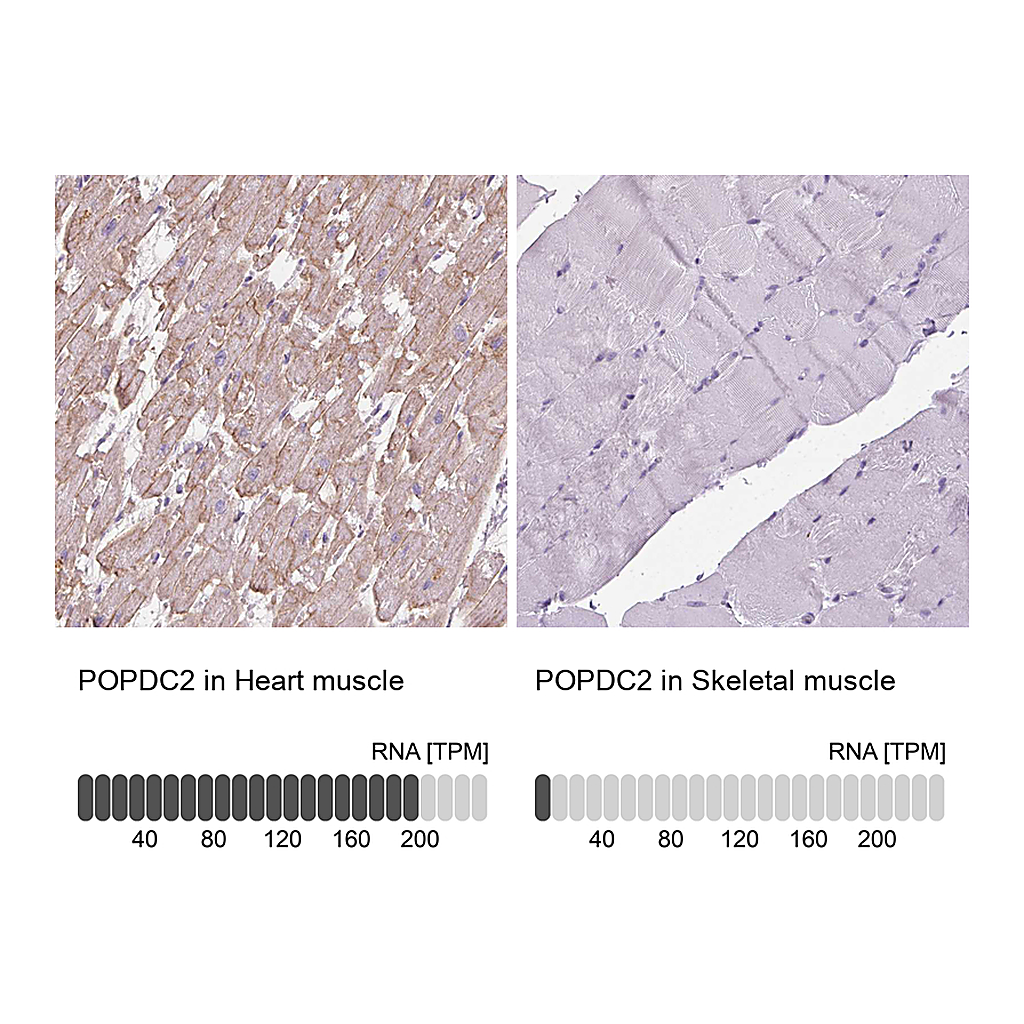 Atlas Antibodies Anti-POPDC2 Antibody