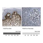 Atlas Antibodies Anti-POSTN Antibody