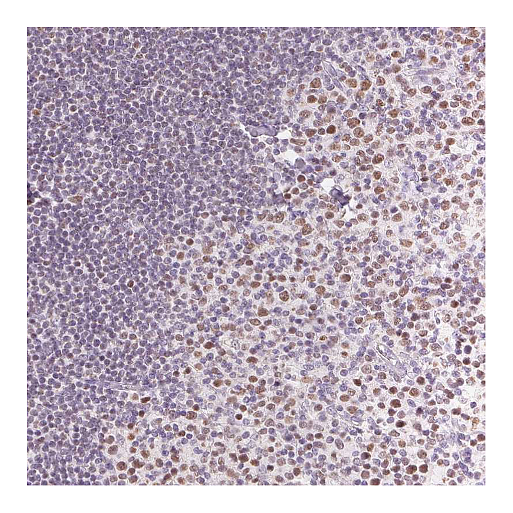 Atlas Antibodies Anti-POU2F2 Antibody
