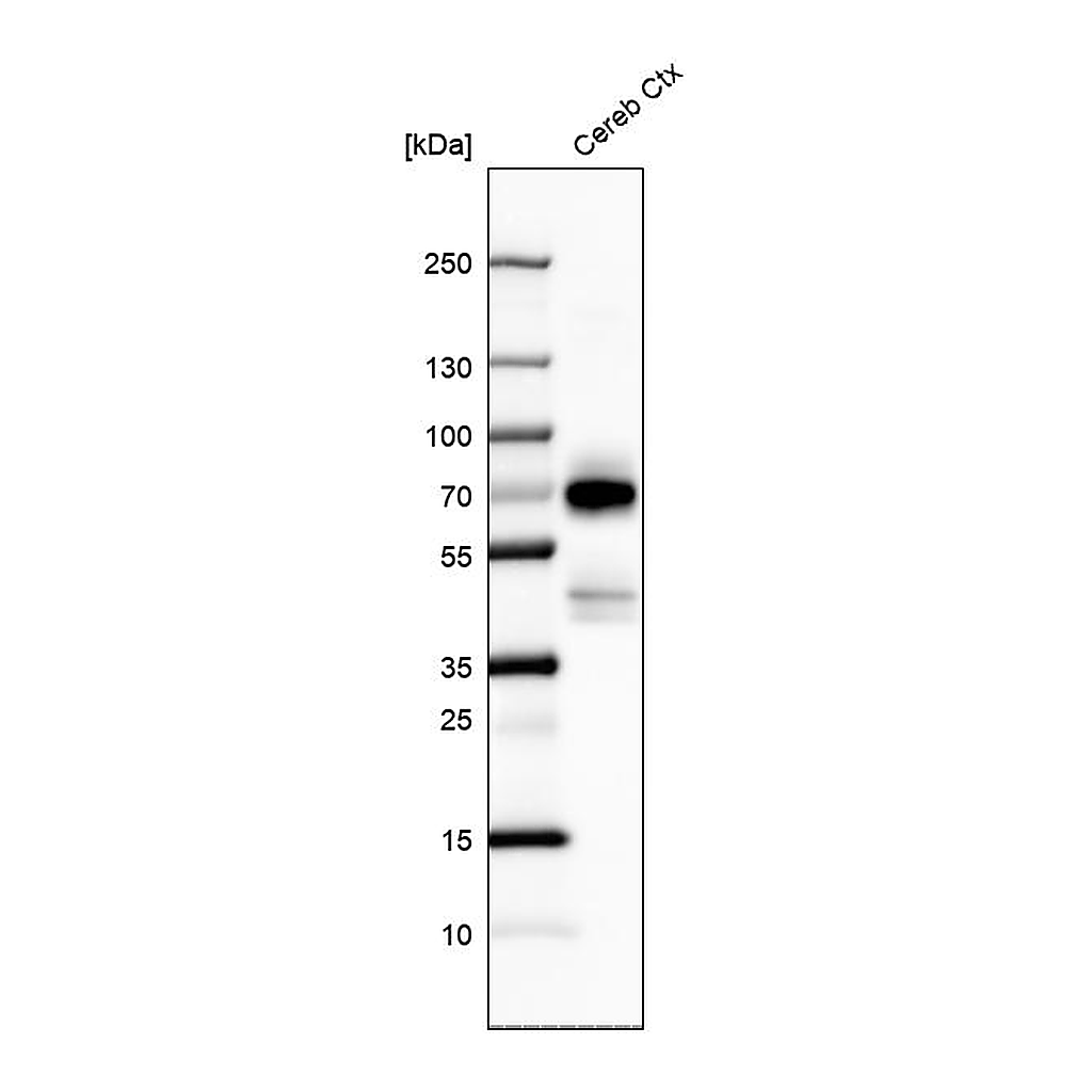 Atlas Antibodies Anti-POU3F4 Antibody