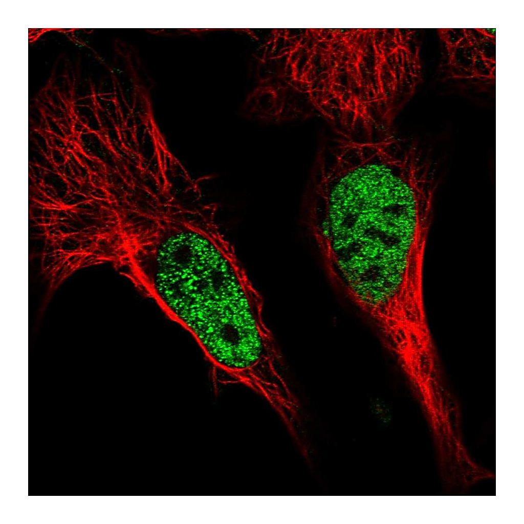 Atlas Antibodies Anti-POU4F3 Antibody