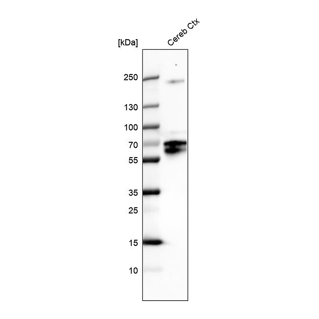 Atlas Antibodies Anti-POU3F4 Antibody