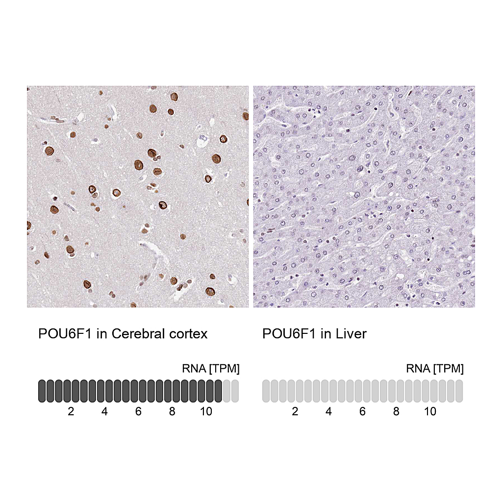 Atlas Antibodies Anti-POU6F1 Antibody