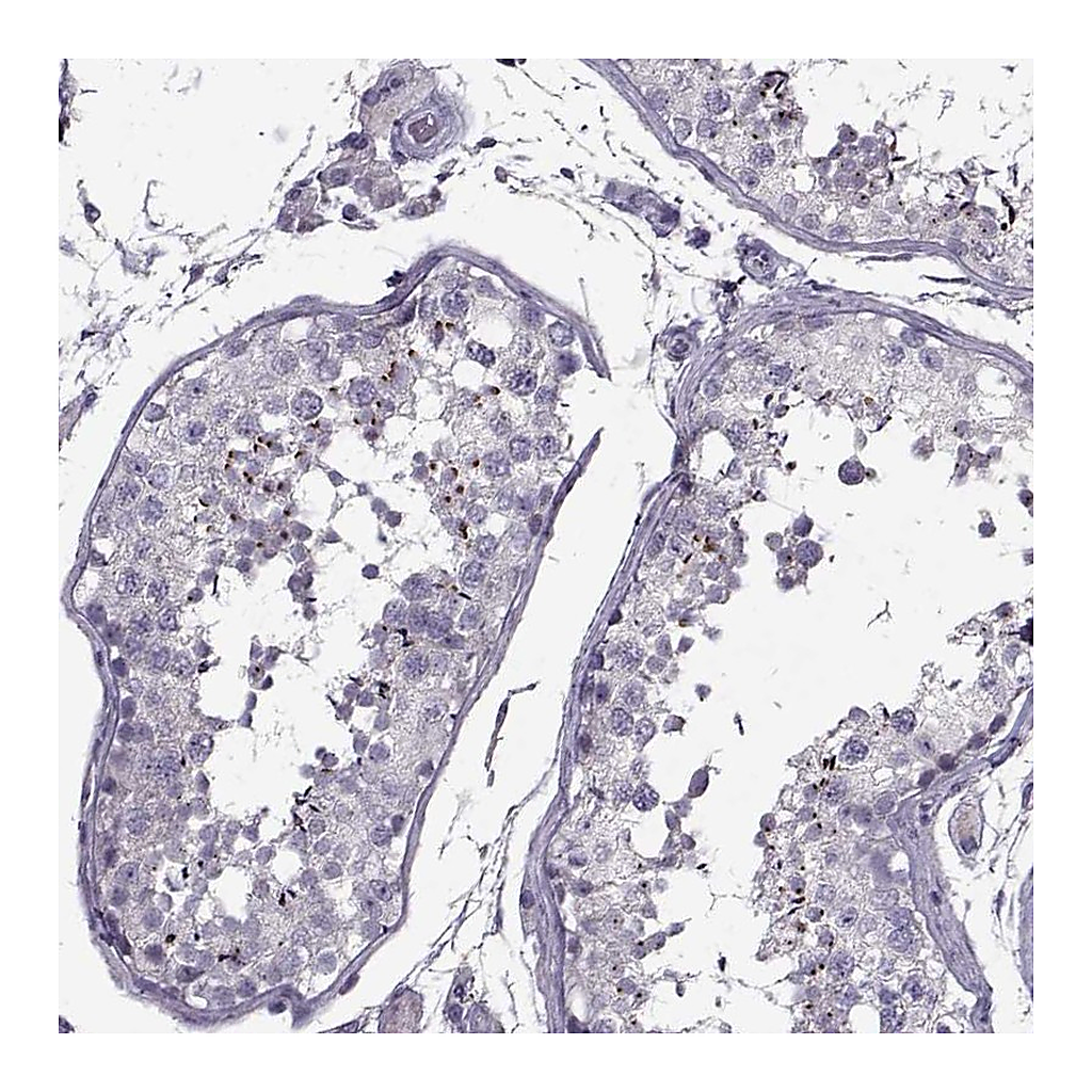 Atlas Antibodies Anti-PP2D1 Antibody