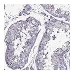 Atlas Antibodies Anti-PP2D1 Antibody