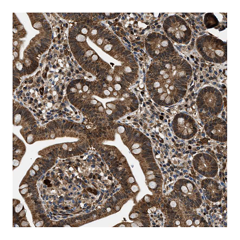 Atlas Antibodies Anti-PPA1 Antibody