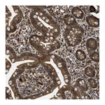 Atlas Antibodies Anti-PPA1 Antibody