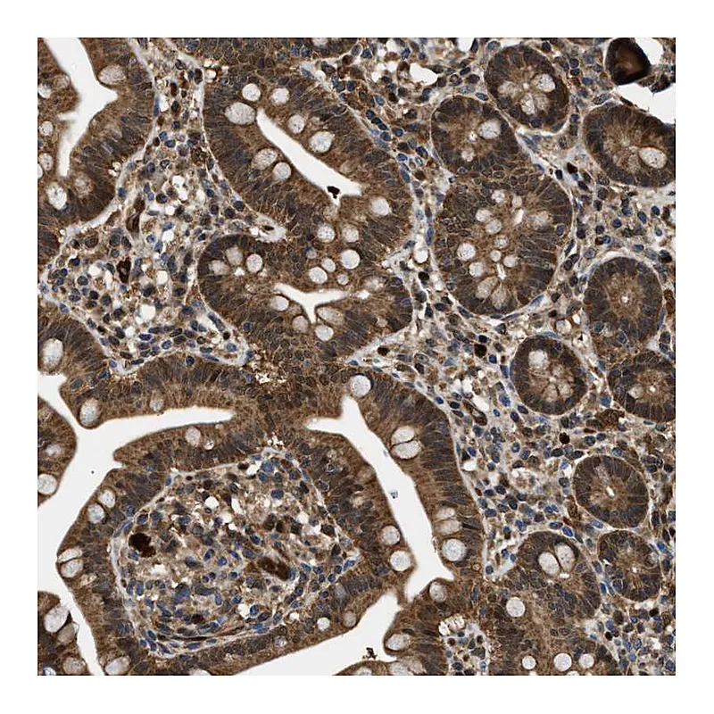 Atlas Antibodies Anti-PPA1 Antibody